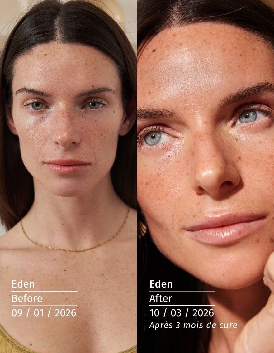 complement alimentaire autobronzant valebio before after